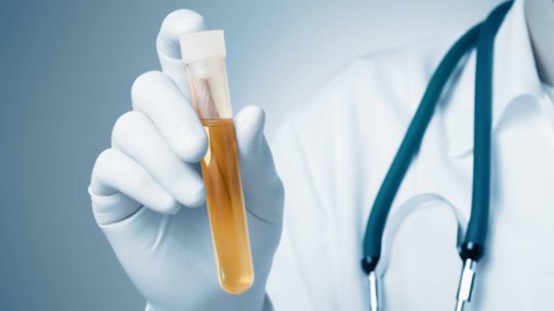 Xét nghiệm thiếu nước được sử dụng giúp chẩn đoán bệnh đái tháo nhạt Xét nghiệm thiếu nước được sử dụng giúp chẩn đoán bệnh đái tháo nhạt