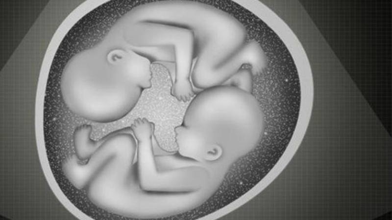 Enzyme cystine aminopeptidase của nhau thai có hoạt tính vasopressinase gây tăng phân hủy ADH Enzyme cystine aminopeptidase của nhau thai có hoạt tính vasopressinase gây tăng phân hủy ADH