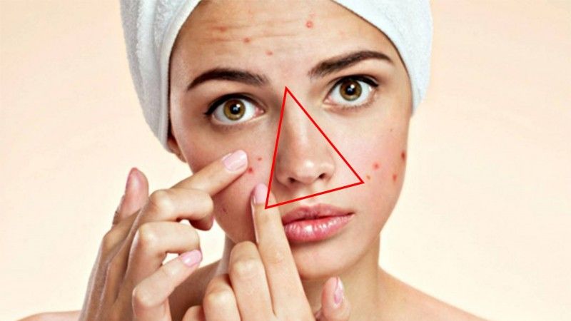 Hạn chế chạm vào mụn và da mặt để tránh kích ứng làn da bị tổn thương Hạn chế chạm vào mụn và da mặt để tránh kích ứng làn da bị tổn thương