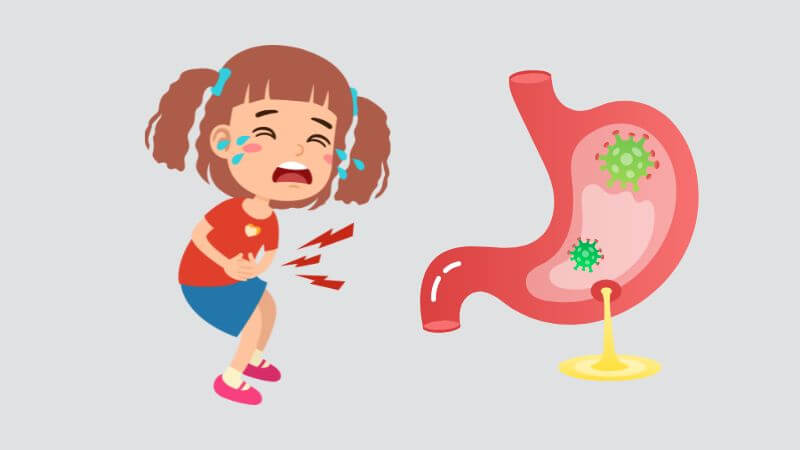 Bài thuốc trị đau dạ dày, loét dạ dày, hành tá tràng, lỵ