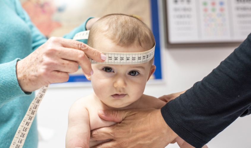 Chu vi vòng đầu của trẻ là một chỉ số quan trọng trong theo dõi sự phát triển của trẻ