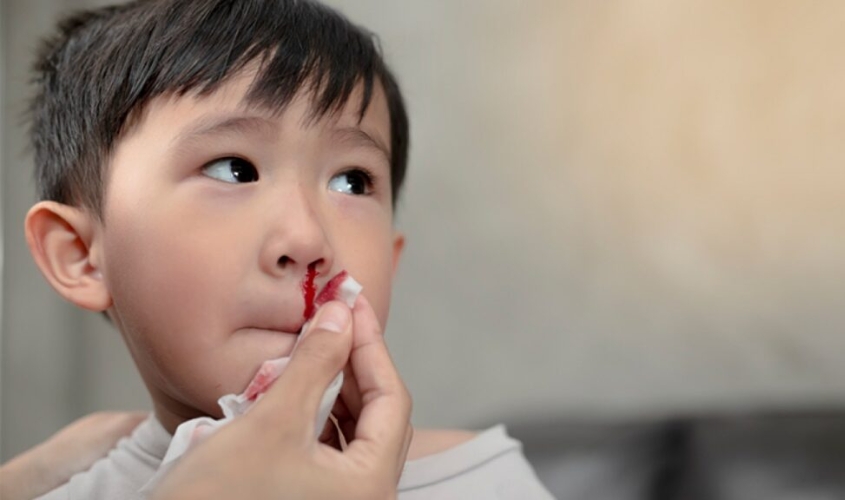 Thường xuyên ngoáy mũi cũng có thể gây ra tình trạng chảy máu cam
