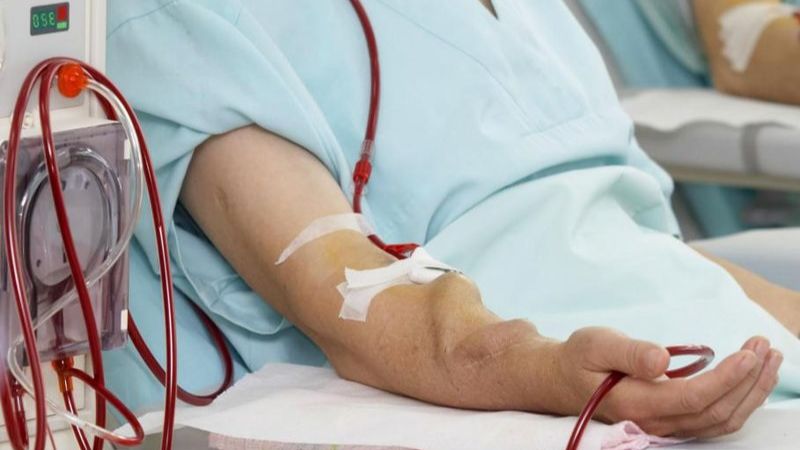 Hình ảnh lọc máu trên bệnh nhân suy thận