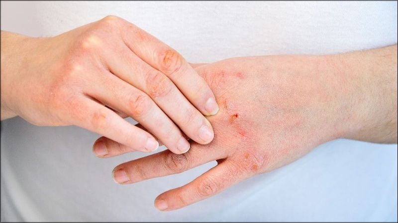 Bạn nên mang bao tay khi tiếp xúc với nước để tránh làm khô da tay