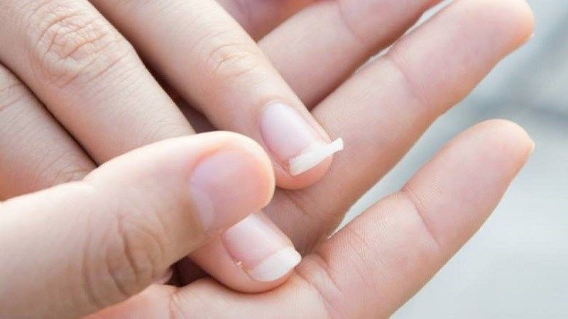 Tránh dùng móng tay làm việc nặng sẽ dễ gãy móng