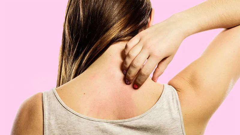 Người bị dị ứng không nên ăn đu đủ Người bị dị ứng không nên ăn đu đủ