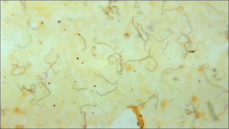Soi tươi nước tiểu nhằm tìm kiếm bằng chứng nhiễm xoắn khuẩn Leptospira