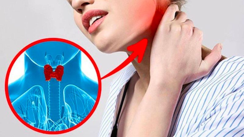 Tyrosine trong các thuốc giảm cân gây ra các bệnh lý về tuyến giáp