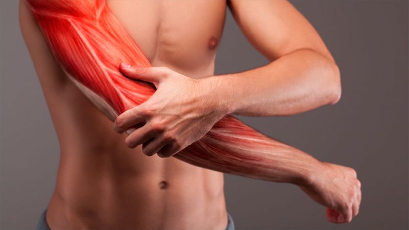 Mỏi cơ là tình trạng cơ giảm khả năng hình thành lực Mỏi cơ là tình trạng cơ giảm khả năng hình thành lực