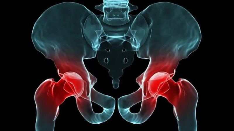 Viêm khớp có thể dẫn tới mỏi cơ kéo dài Viêm khớp có thể dẫn tới mỏi cơ kéo dài