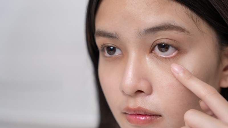 Khô môi có thể xuất hiện kèm với khô mắt hay khô miệng Khô môi có thể xuất hiện kèm với khô mắt hay khô miệng