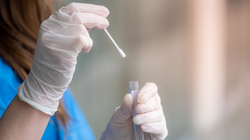 B&aacute;c sĩ c&oacute; thể tiến h&agrave;nh x&eacute;t nghiệm dịch mũi để t&igrave;m nguy&ecirc;n nh&acirc;n g&acirc;y bệnh