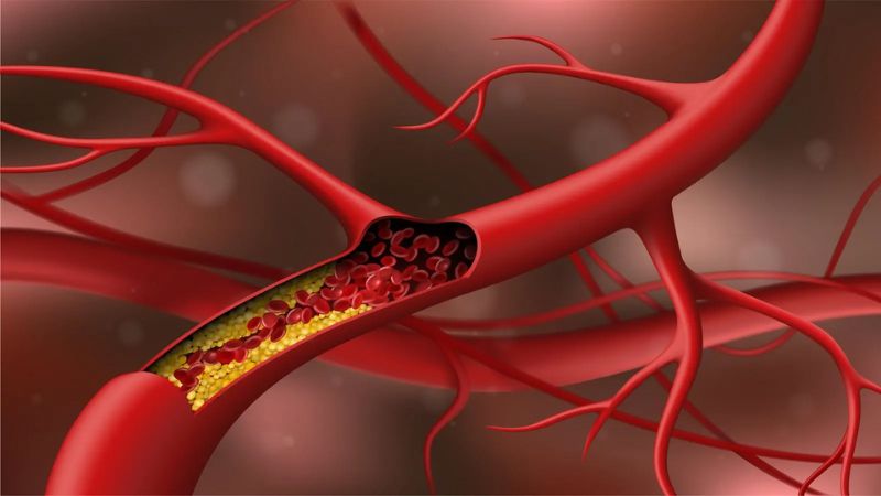 Cây xương khỉ có tác dụng cải thiện quá trình chuyển hóa lipid 