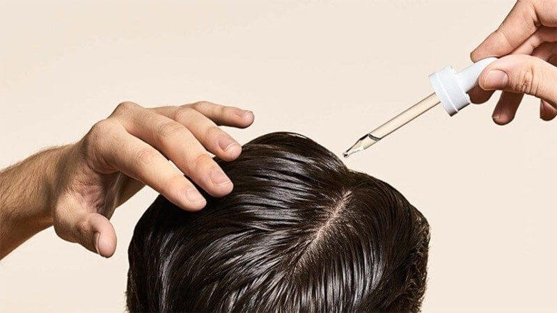 Tinh dầu nghệ sẽ hữu ích nếu bạn đang bị rụng tóc do nhiễm nấm Tinh dầu nghệ sẽ hữu ích nếu bạn đang bị rụng tóc do nhiễm nấm