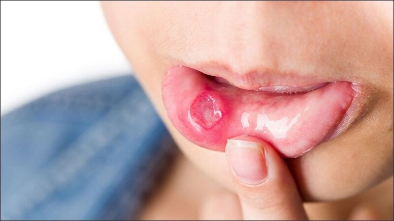 Ăn rau lang giúp thanh nhiệt, giải độc cơ thể