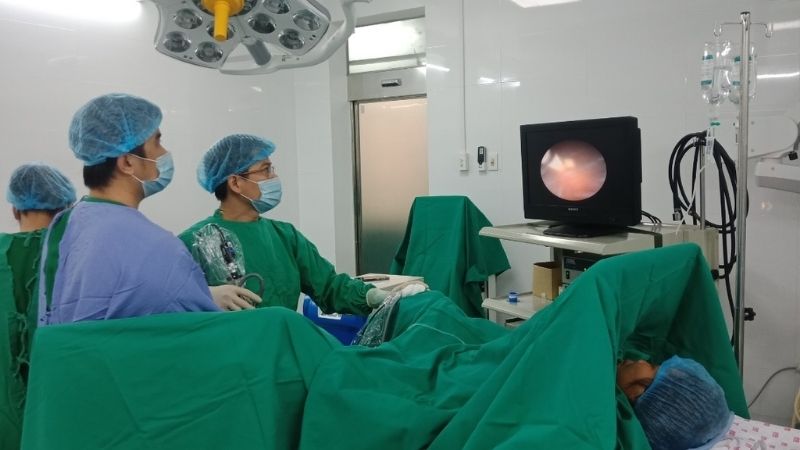 Tán sỏi qua da cần máy móc thiết bị hiện đại nên chi phí phẫu thuật cao Tán sỏi qua da cần máy móc thiết bị hiện đại nên chi phí phẫu thuật cao