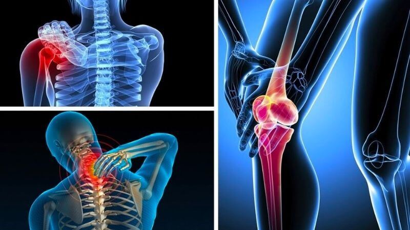 Cây bách bệnh còn được coi là một vị thuốc quý trong việc điều trị các chứng bệnh liên quan đến xương khớp như đau nhức xương khớp, thoái hóa cột sống, tê bì chân tay