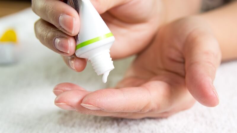 Bác sĩ có thể chỉ định các loại thuốc bôi kháng nấm để điều trị mụn nước ở chân Bác sĩ có thể chỉ định các loại thuốc bôi kháng nấm để điều trị mụn nước ở chân