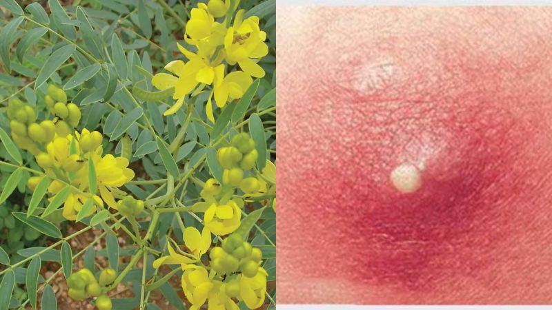 Lấy lá phan tả diệp sắc nước uống giúp thanh nhiệt, chữa mụn nhọt