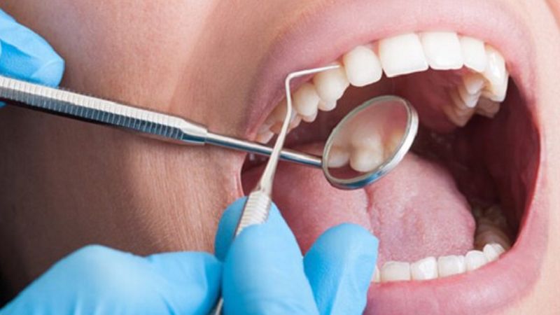 Sau các thủ thuật nha khoa cảm thấy răng ê nhức là điều bình thường