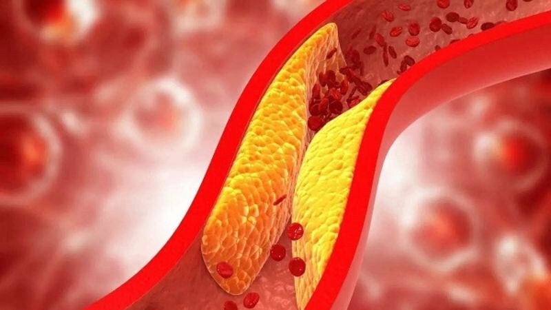 Chất xơ hòa tan có trong đậu xanh giúp giảm nồng độ cholesterol LDL trong máu