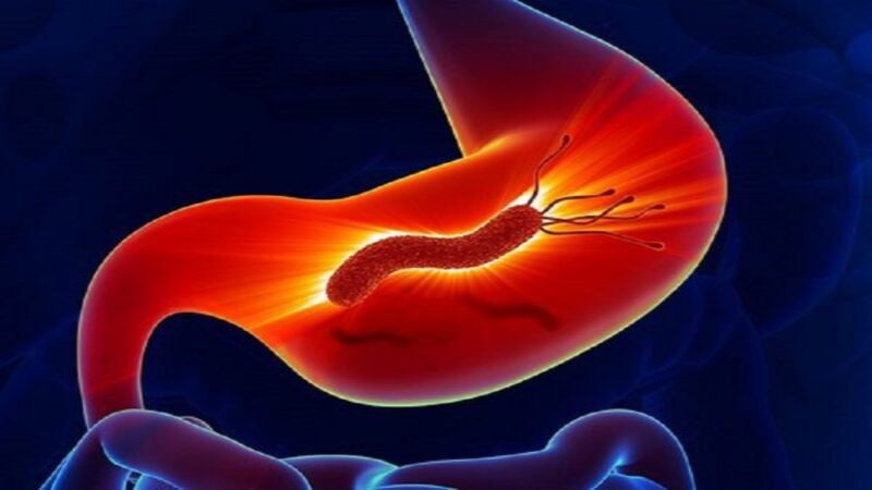 Các chất chống viêm trong mực giúp giảm viêm dạ dày do vi khuẩn Helicobacter pylori Các chất chống viêm trong mực giúp giảm viêm dạ dày do vi khuẩn Helicobacter pylori