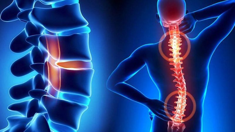 Cẩu tích giúp tăng cường sức mạnh của xương và ngăn ngừa loãng xương