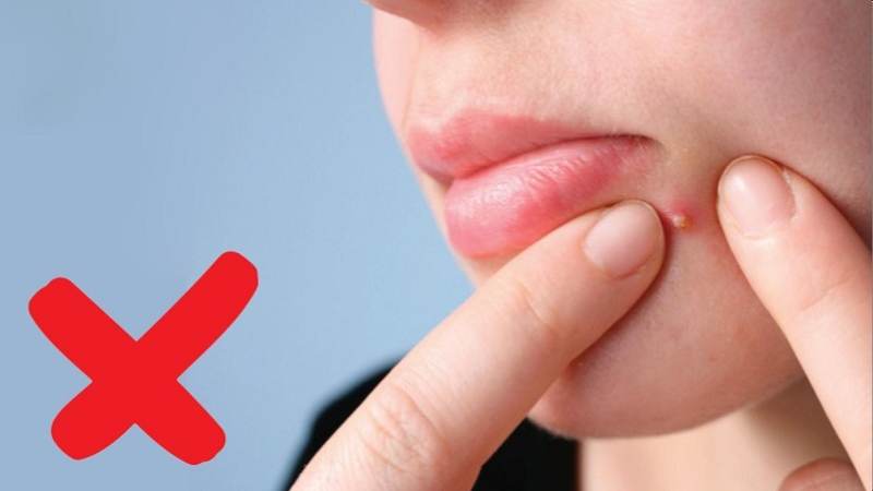 Dùng tay nặn mụn dẫn đến tình trạng viêm nặng hơn và gây sẹo