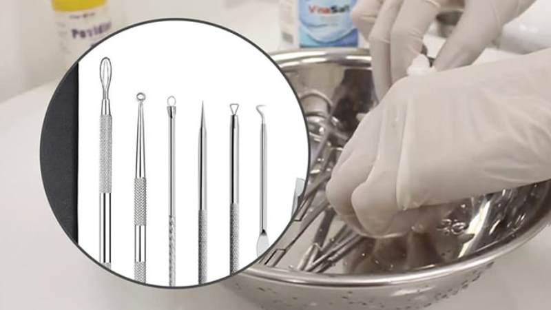 Dụng cụ và da không được vệ sinh tạo điều kiện đưa vi khuẩn vào các vết nặn mụn 