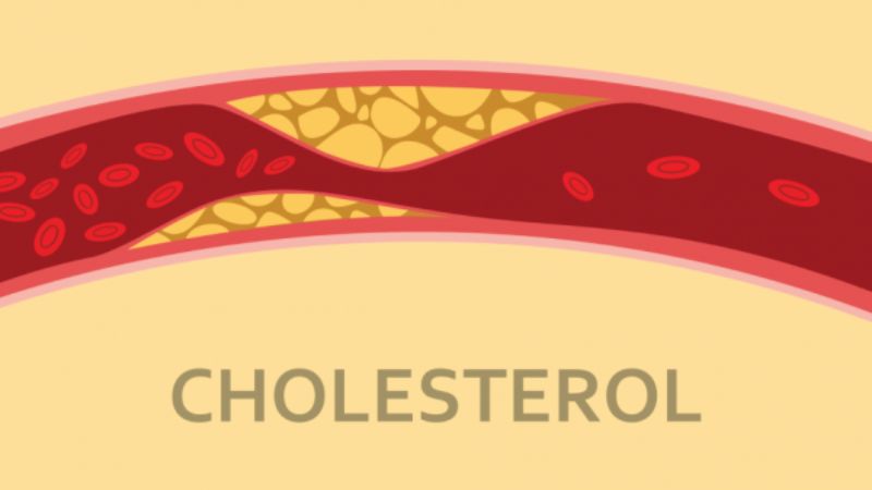Kiểm soát nồng độ cholesterol cũng giúp giảm men gan hiệu quả