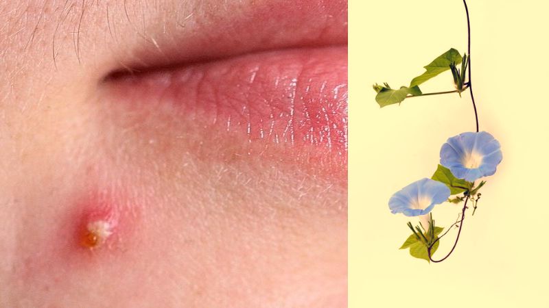Đắp và uống lá bìm bìm tươi giúp giảm tình trạng mụn nhọt