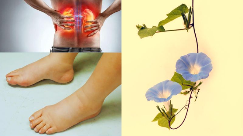 Bài thuốc từ khiên ngưu tử, táo tàu và gừng hỗ trợ tình trạng phù thũng do viêm thận