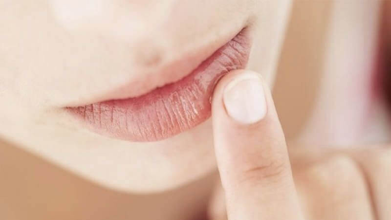 Sử dụng son dưỡng môi thường xuyên cũng có tác dụng làm giảm vết thâm, đốm đen