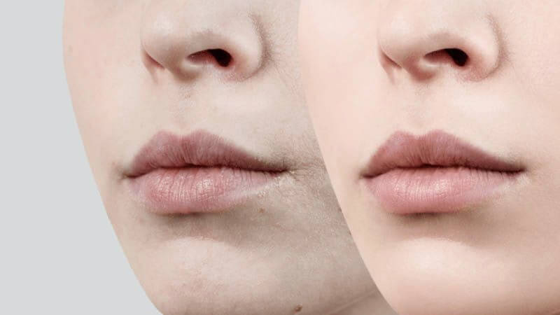 Nhiều loại son dưỡng môi trên thị trường chứa các thành phần hóa học có thể tiềm ẩn nguy cơ cho sức khỏe như paraffin, petrolatum, thuốc nhuộm và phenol