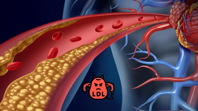Tinh bột kháng giúp làm giảm lượng cholesterol xấu - nguyên nhân chính gây xơ vữa động mạch 