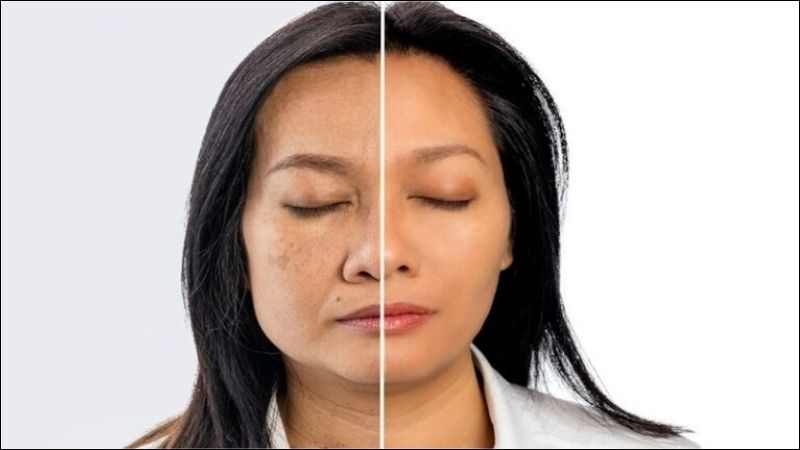 Các chất chống oxy hóa có trong cây ké đầu ngựa giúp làm chậm quá trình lão hóa
