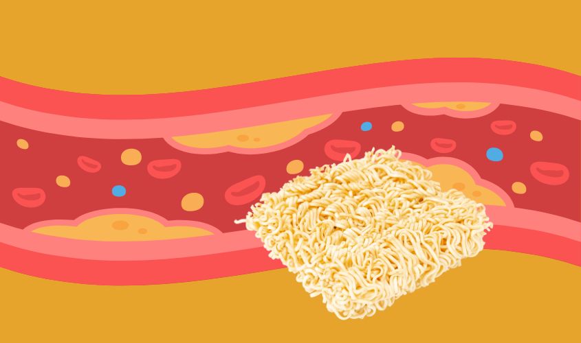 Hình ảnh thể hiện việc dùng nhiều mì sẽ làm tăng cholesterol trong máu Hình ảnh thể hiện việc dùng nhiều mì sẽ làm tăng cholesterol trong máu