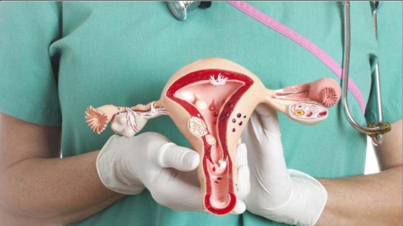 Sử dụng chiết xuất rễ cây cỏ sữa lá nhỏ hỗ trợ cải thiện rối loạn chức năng sinh sản ở phụ nữ