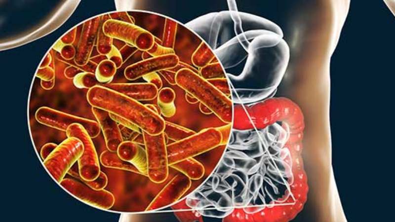 Sắc cây cỏ sữa lá nhỏ với nước uống trong ngày giúp chữa lỵ trực trùng