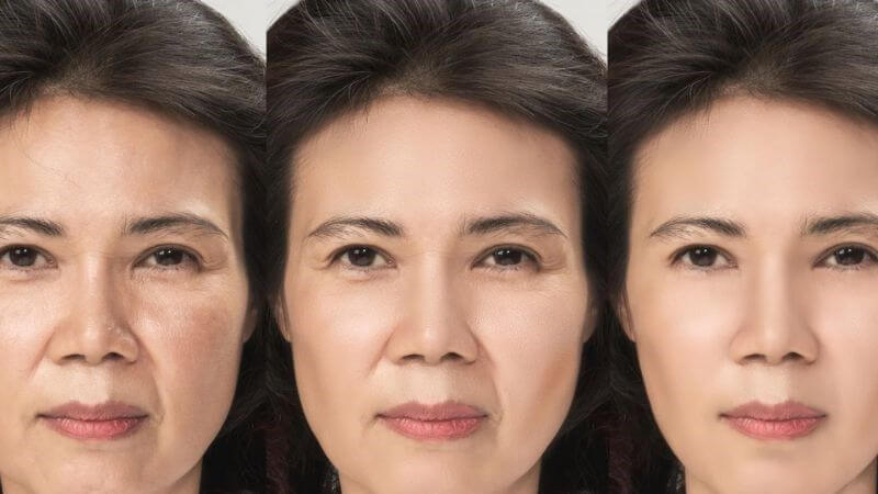 Nhờ đặc tính chống viêm, lô hội thường được dùng để làm dịu bỏng, chữa lành vết thương, viêm da dị ứng và các vấn đề da liễu khác