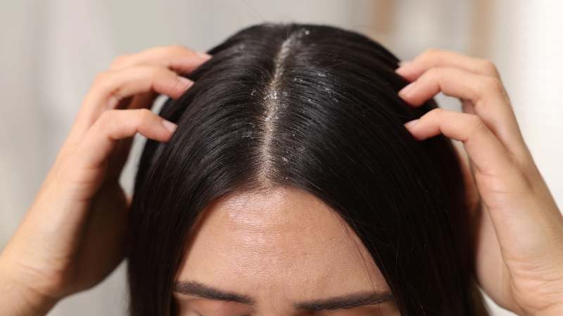 Gội đầu với lá dứa giúp trị gàu