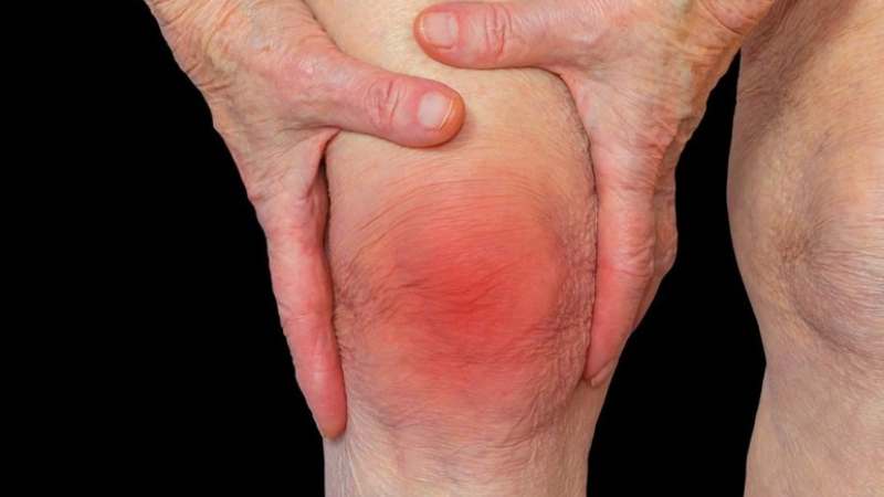 Lá dứa là nguyên liệu dùng trong bài thuốc trị bệnh viêm khớp sưng đau
