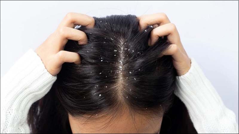 Bột lá dứa giúp loại bỏ gàu khi dùng làm dầu gội nhờ đặc tính kháng khuẩn
