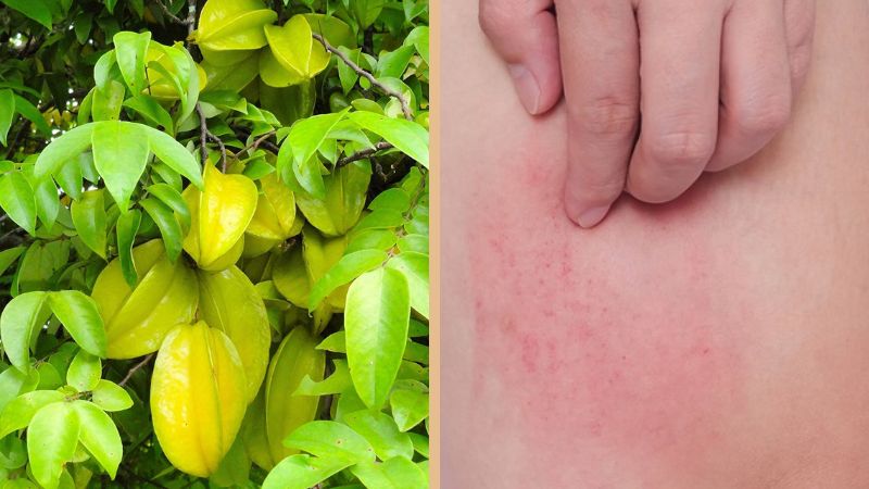 Lá khế có tác dụng hỗ trợ điều trị các vấn đề ngoài da