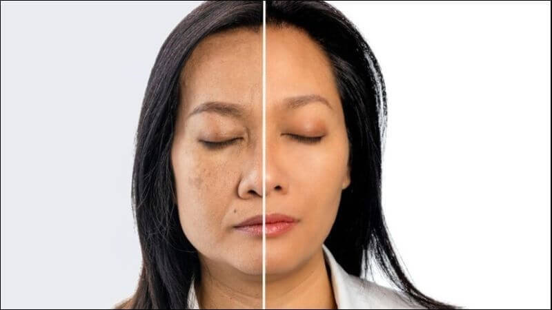 Cây tầm ma chứa vitamin C, pro-vitamin A, kẽm, kali, flavonoid và các nguyên tố vi lượng đóng vai trò như chất chống oxy hóa, bảo vệ tế bào khỏi tổn thương gốc tự do