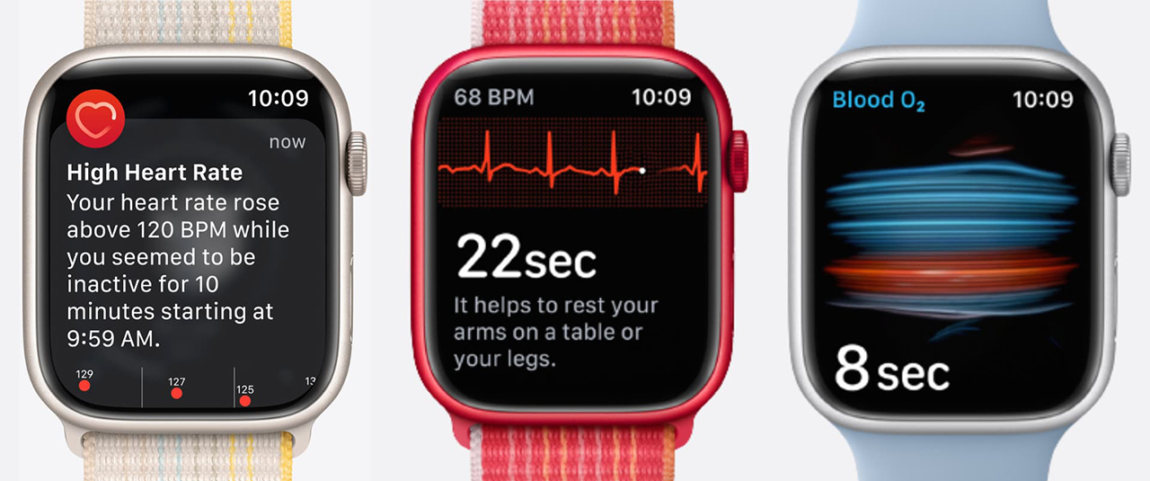 Có nên mua Apple Watch không