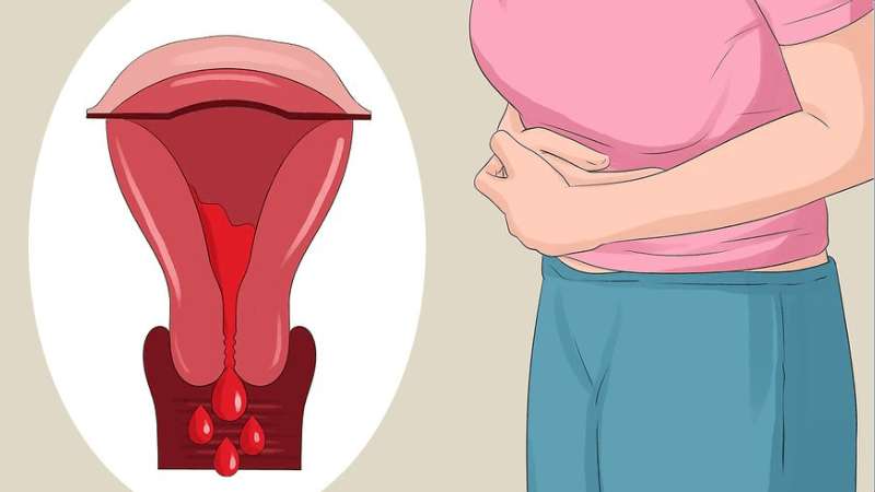 Gác chân lên tường giúp giảm nồng độ cortisol và prostaglandin, giảm nhẹ các cơn đau bụng kinh