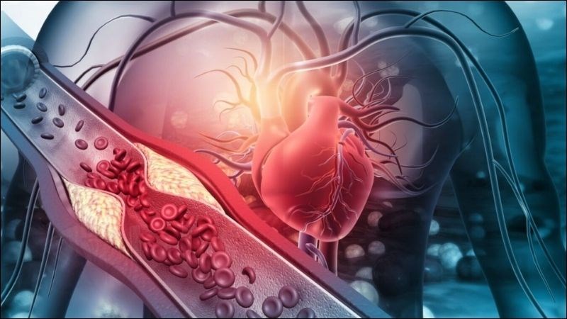 Suy giáp có thể làm giảm chuyển hóa lipid, chậm nhịp tim và tốc độ tuần hoàn máu