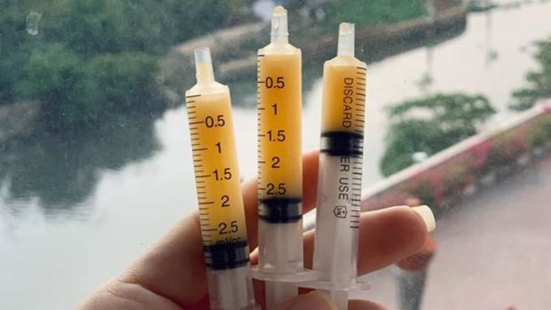 Có thể lưu trữ sữa non trong hộp đựng hoặc ống tiêm vô trùng