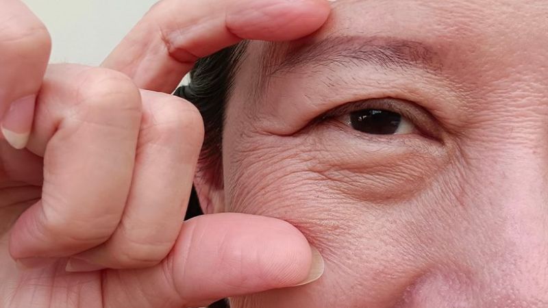 AHA có tác dụng làm chậm quá trình lão hóa và làm mờ các nếp nhăn nông